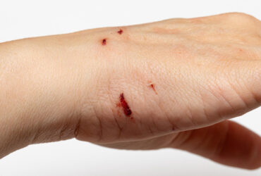 EN-MDLY-B-EM-CN2301-V1_20260219_152914_v1