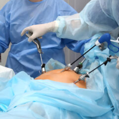 Laparoscopic Hysterectomy: Procedure, Benefits, Risks, and Recovery
